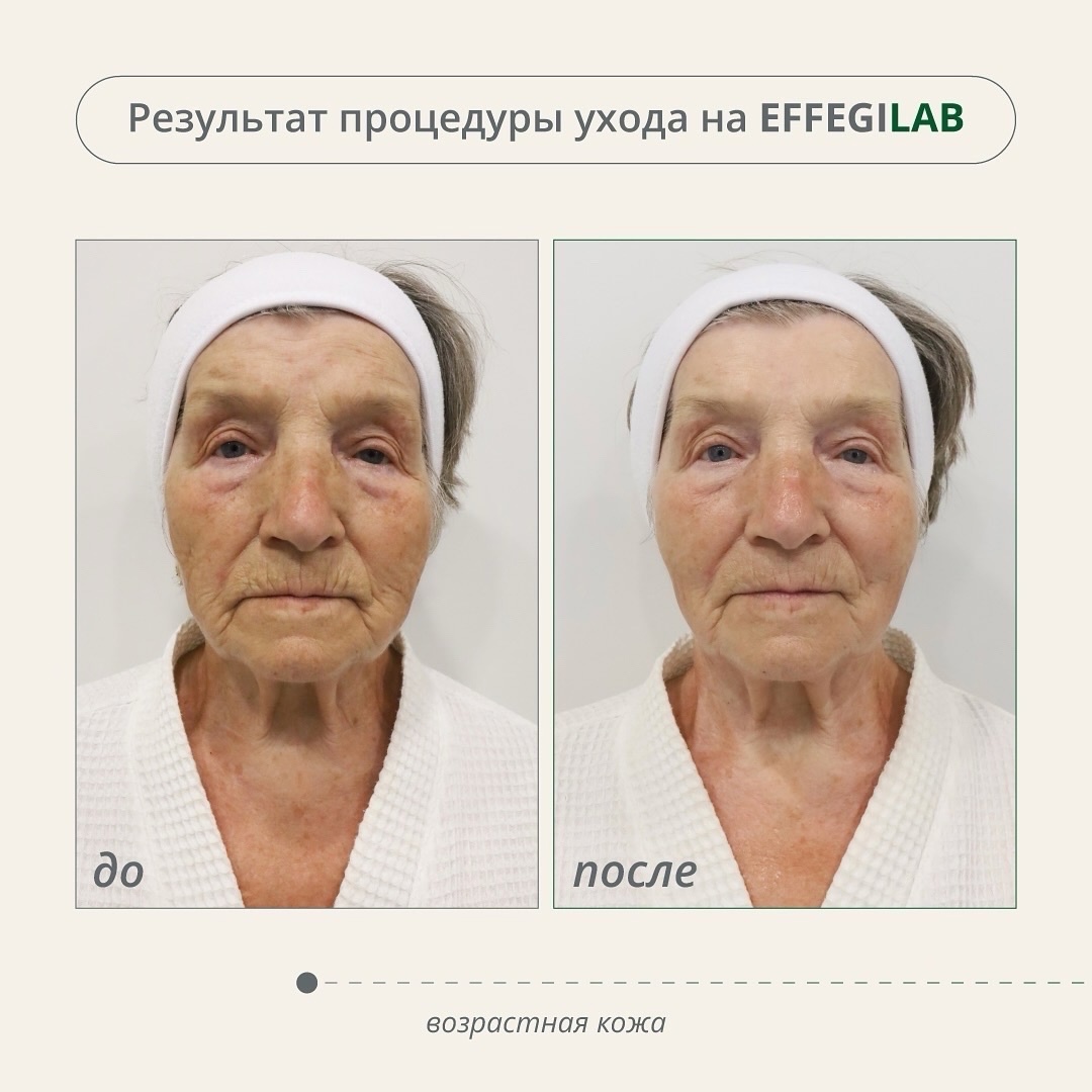 ГАЙД Anti-age по уходу за возрастной кожей!